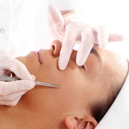 Dermaplaning