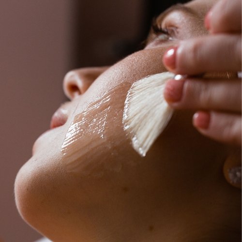 Chemical Peel treatment